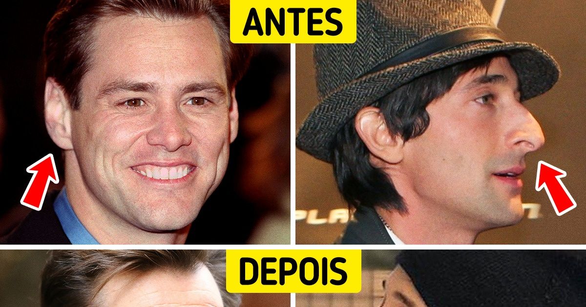 Por que nossas orelhas e nosso nariz ficam maiores com o passar dos anos (e nada pode parar seu crescimento) Por que nossas orelhas e nosso nariz ficam maiores com o passar dos anos (e nada pode parar seu crescimento)