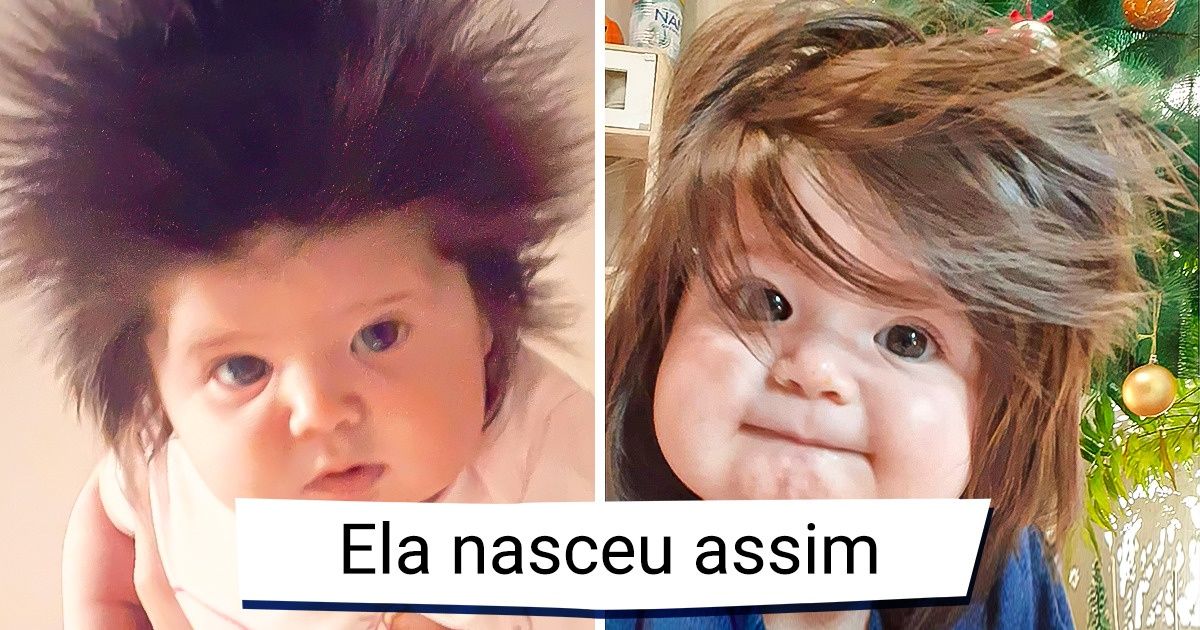 18 Pessoas que ganharam um toque todo especial da Mãe Natureza 18 Pessoas que ganharam um toque todo especial da Mãe Natureza