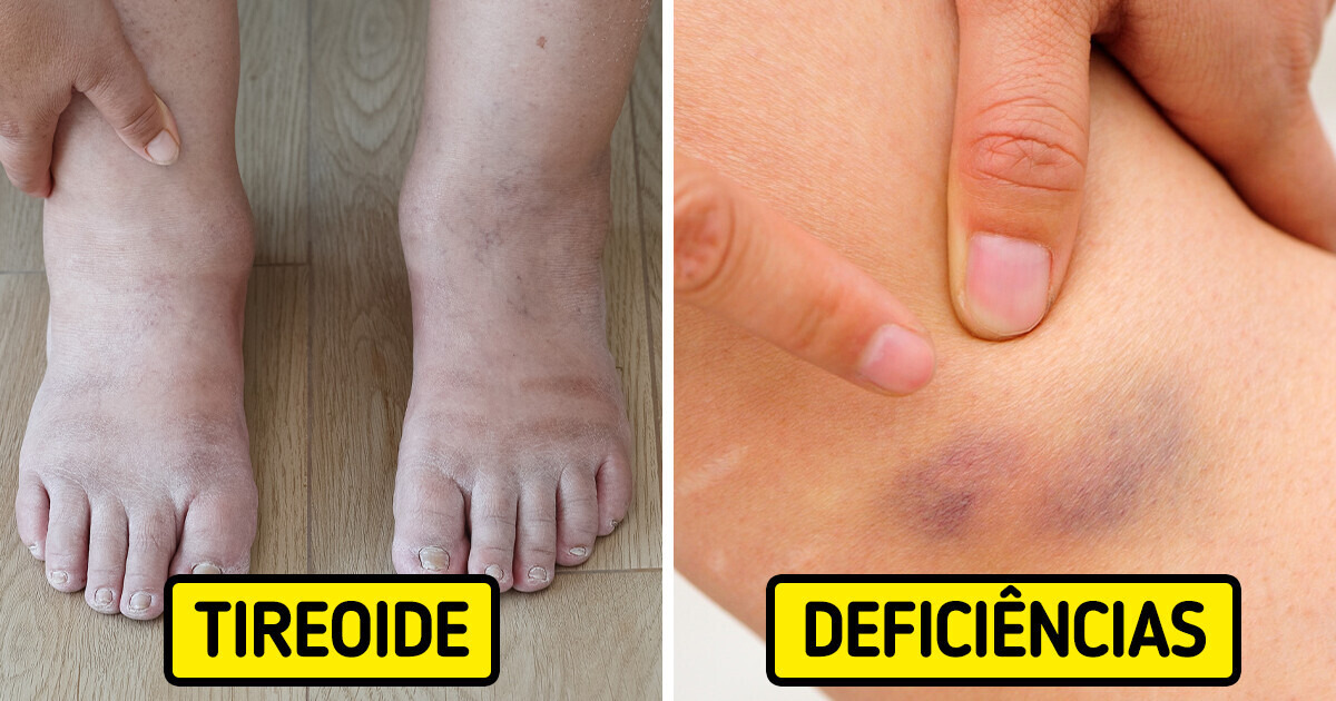14 Sinais de alerta - O que que seu corpo está tentando te dizer 14 Sinais de alerta - O que que seu corpo está tentando te dizer