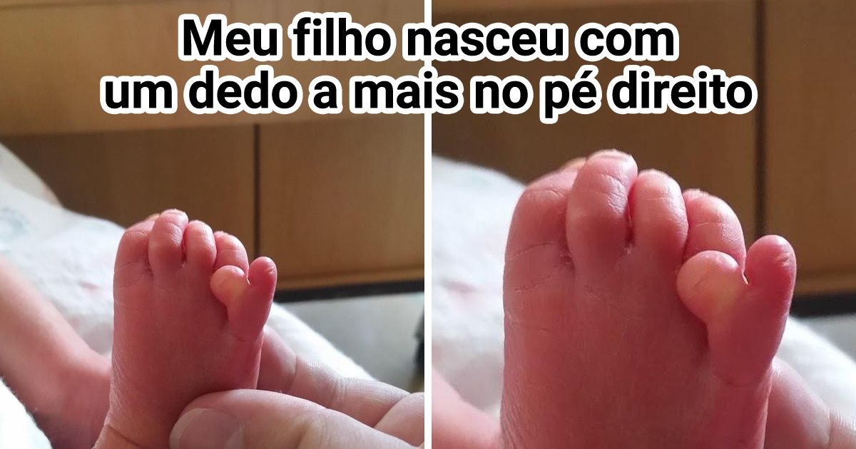 15+ Vezes em que a Mãe Natureza gritou: “Surpresa!”