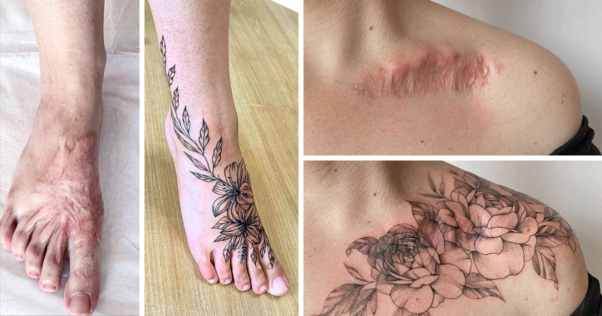 Cicatrizes Transformadas em Obras de Arte: A Beleza por Trás das Marcas Cicatrizes Transformadas em Obras de Arte: A Beleza por Trás das Marcas