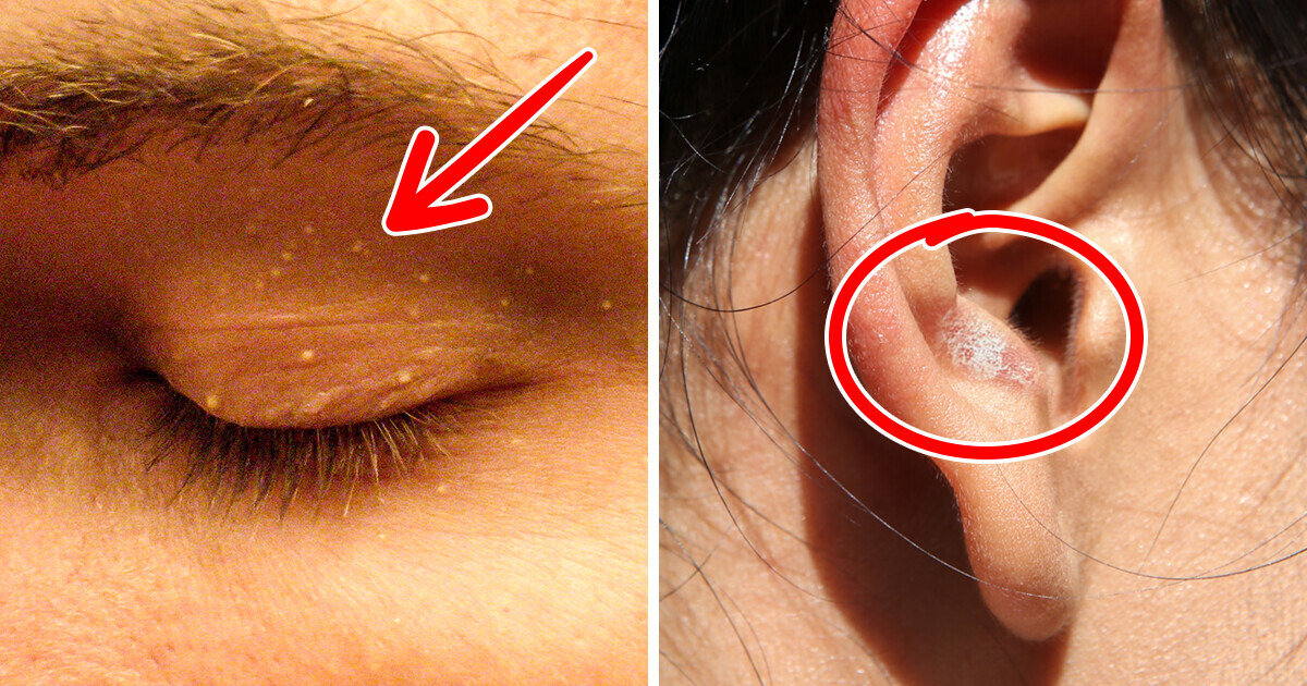 6 Sinais sutis na face que podem indicar doenças graves e você não deve ignorar 6 Sinais sutis na face que podem indicar doenças graves e você não deve ignorar