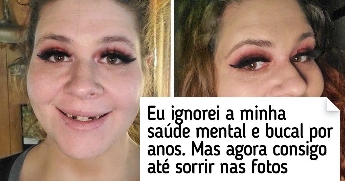 15 Fotos emocionantes de internautas que superaram medos, derrubaram barreiras e venceram os obstáculos da vida 15 Fotos emocionantes de internautas que superaram medos, derrubaram barreiras e venceram os obstáculos da vida