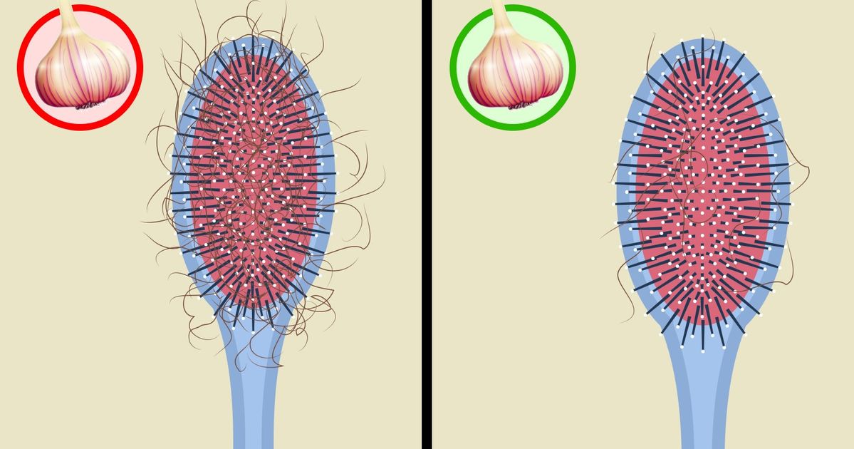 O que acontecerá se você começar a comer alho todos os dias? O que acontecerá se você começar a comer alho todos os dias?