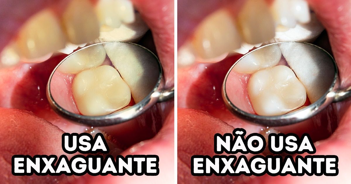 6 Hábitos que podem manchar os seus dentes 6 Hábitos que podem manchar os seus dentes