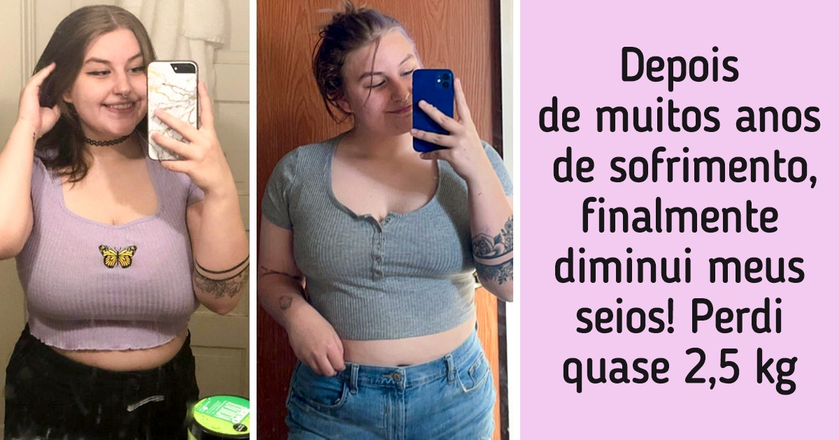 15 Pessoas que não deixaram nada atrapalhar o seu caminho na busca da aparência dos sonhos 15 Pessoas que não deixaram nada atrapalhar o seu caminho na busca da aparência dos sonhos