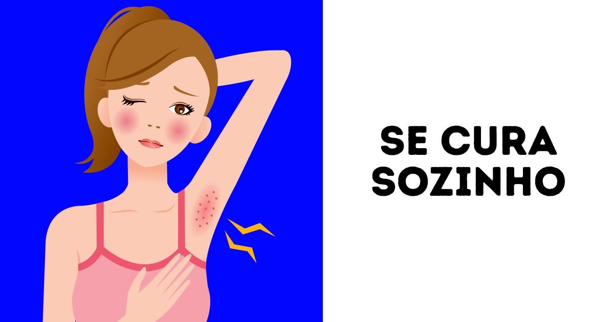 10 Informações sobre o furúnculo para acabar com esse problema