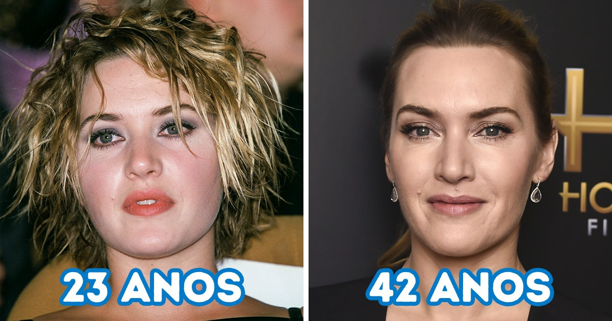 15 Estrelas que adotaram um estilo natural de maquiagem e enfatizaram ainda mais sua beleza 15 Estrelas que adotaram um estilo natural de maquiagem e enfatizaram ainda mais sua beleza