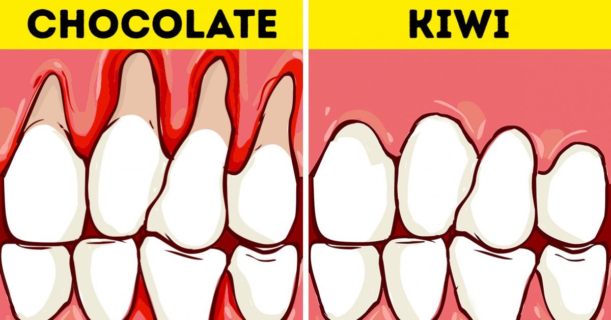 Como conservar a saúde dos dentes e branqueá-los com ajuda da comida Como conservar a saúde dos dentes e branqueá-los com ajuda da comida