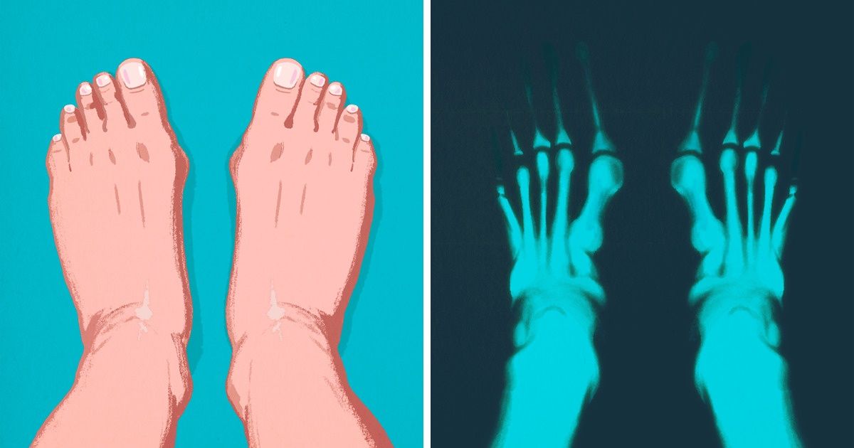 7 Características do corpo humano que nos tornam animais vulneráveis 7 Características do corpo humano que nos tornam animais vulneráveis