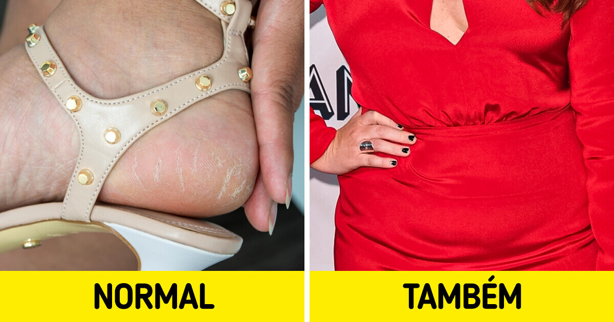 16 Tabus que a mulher moderna não tem medo de mostrar