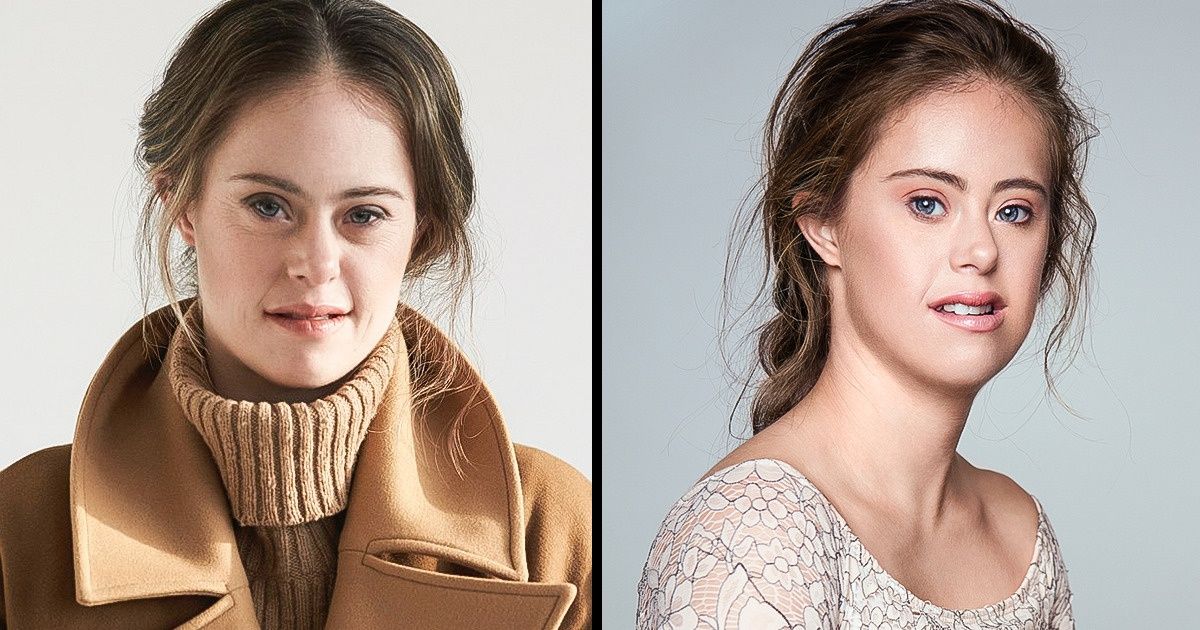 Modelo com síndrome de Down prova que você é a única pessoa capaz de definir sua própria beleza Modelo com síndrome de Down prova que você é a única pessoa capaz de definir sua própria beleza