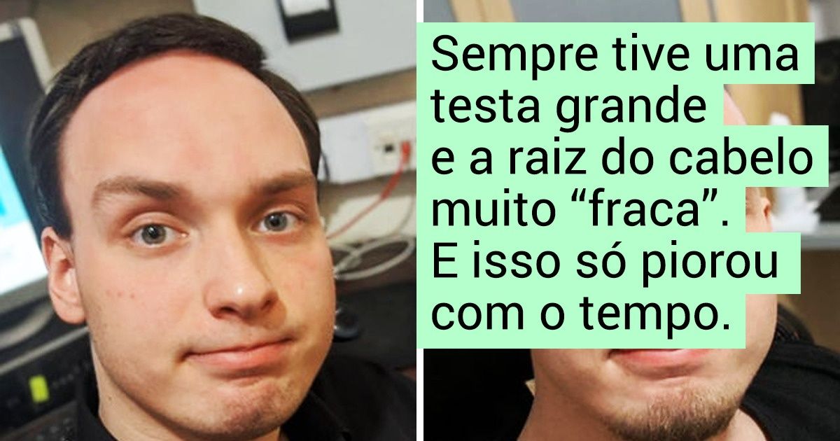 20+ Homens que decidiram dar uma chance à calvície e não voltaram atrás
