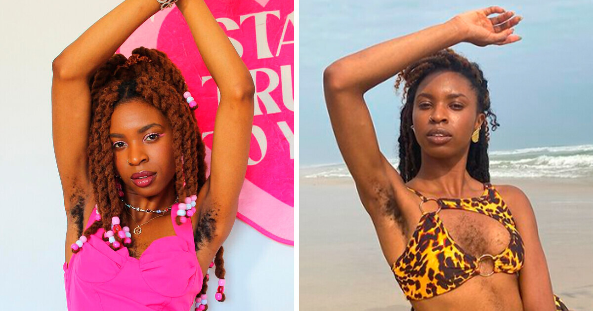 Alguns a chamam de doente, mas ela exibe orgulhosamente seus pelos corporais Alguns a chamam de doente, mas ela exibe orgulhosamente seus pelos corporais