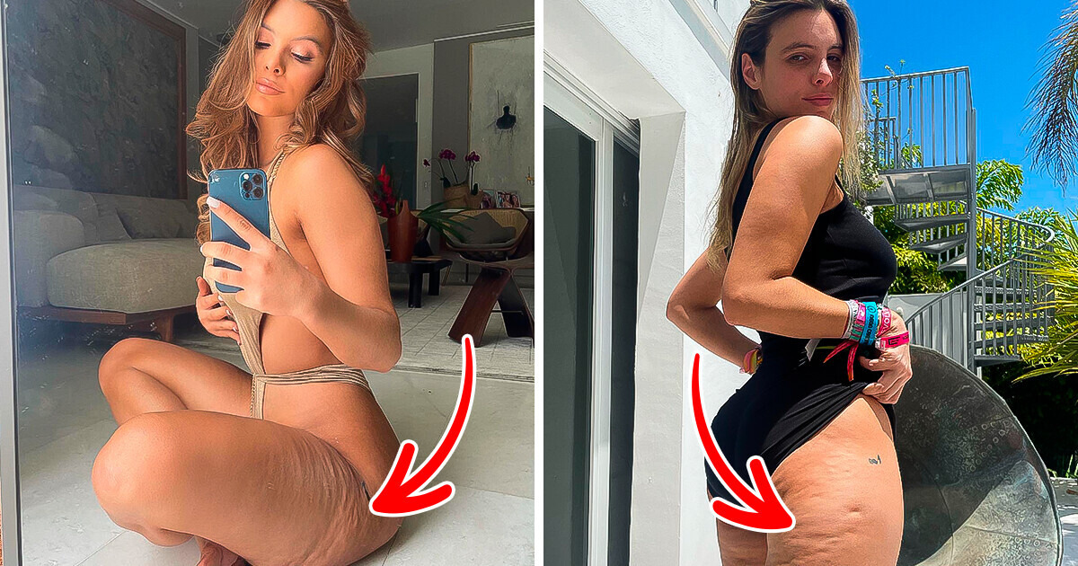 Youtuber venezuelana, Lele Pons, mostra suas imperfeições ao mundo e recebe críticas Youtuber venezuelana, Lele Pons, mostra suas imperfeições ao mundo e recebe críticas