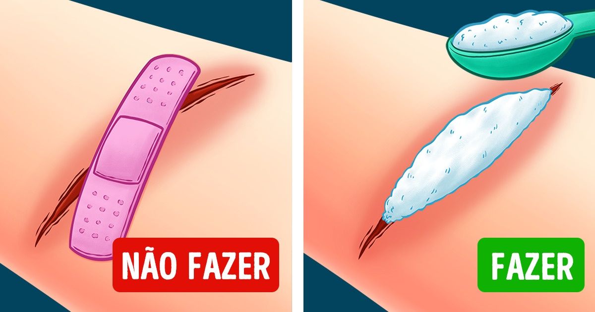 10+ Dicas rápidas de primeiros socorros que podem nos ajudar em situações de emergência