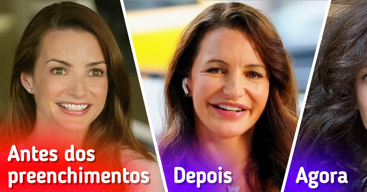 Kristin Davis retira preenchimentos do rosto e deixa seus fãs admirados Kristin Davis retira preenchimentos do rosto e deixa seus fãs admirados