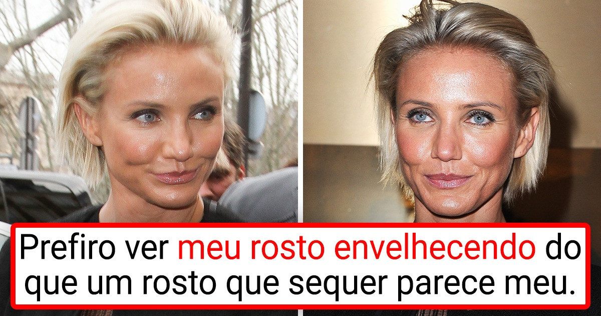 8 Celebridades que chegaram a fazer cirurgias plásticas, mas hoje garantem que “nunca mais” 8 Celebridades que chegaram a fazer cirurgias plásticas, mas hoje garantem que “nunca mais”