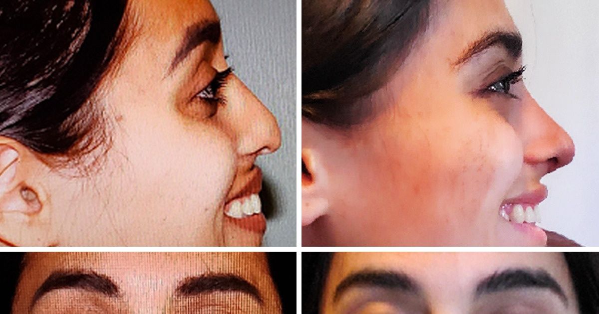 13 Pessoas que conquistaram um sucesso incrível na busca pelo corpo ideal