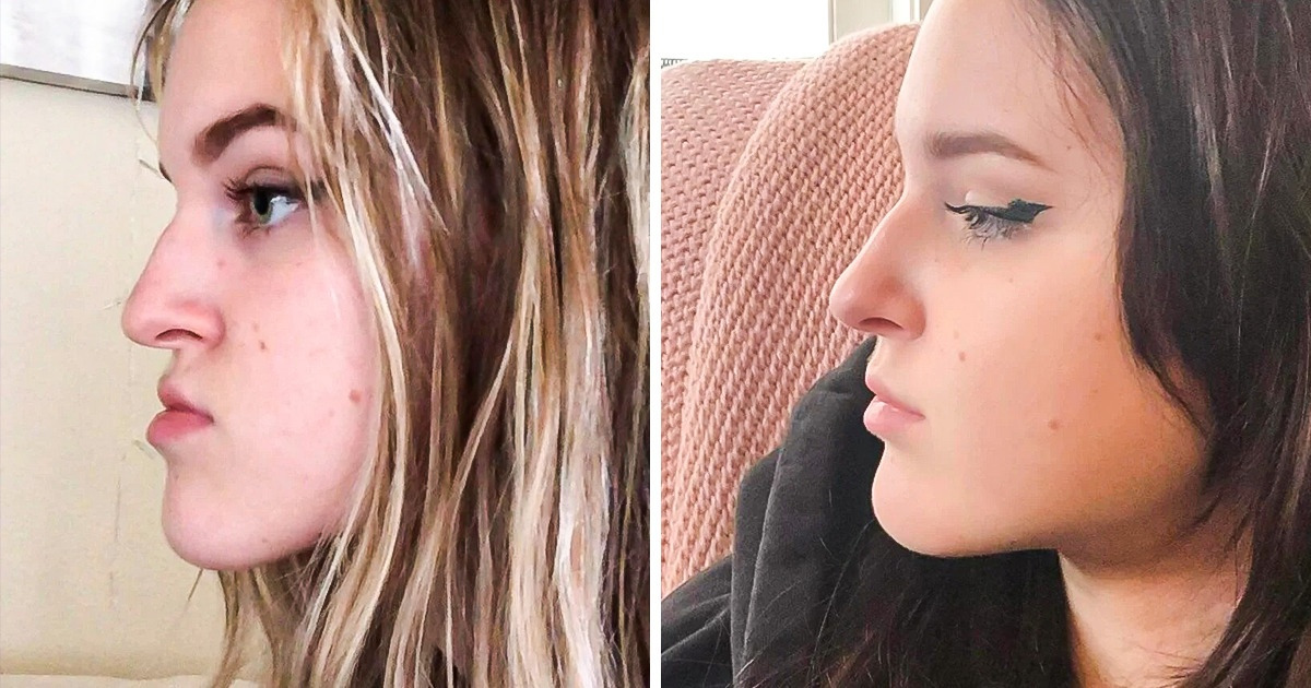 20 Fotos motivadoras que mostram o progresso e como as pessoas podem evoluir com o tempo