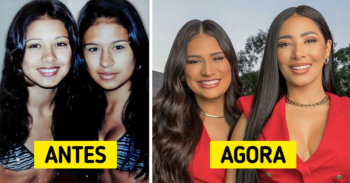 13 Celebridades que superaram uma infância difícil e alcançaram o estrelato 13 Celebridades que superaram uma infância difícil e alcançaram o estrelato