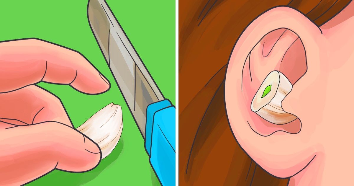 Alho não é bom só na cozinha. É também um santo remédio Alho não é bom só na cozinha. É também um santo remédio