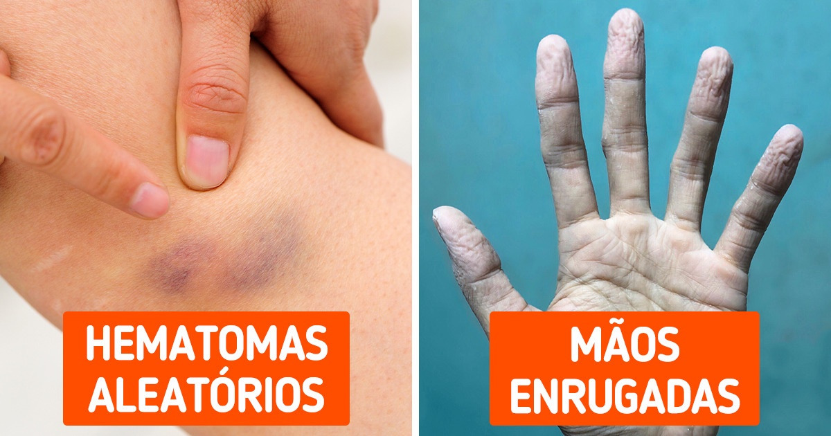 11 Sinais de que seu corpo está lhe dando alertas importantes
