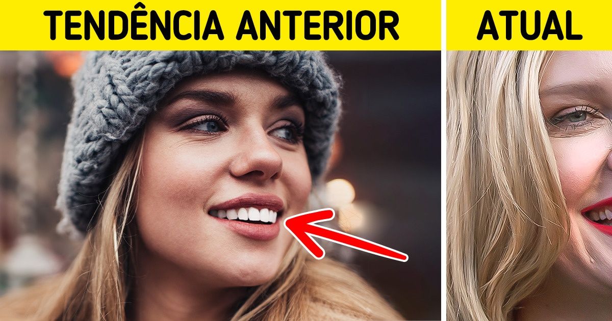 14 Procedimentos de beleza que ontem estavam no auge da popularidade e hoje muitos os evitam