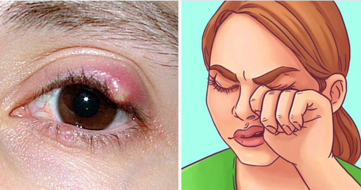 10 Vezes em que seus olhos pediram socorro, e você nem percebeu