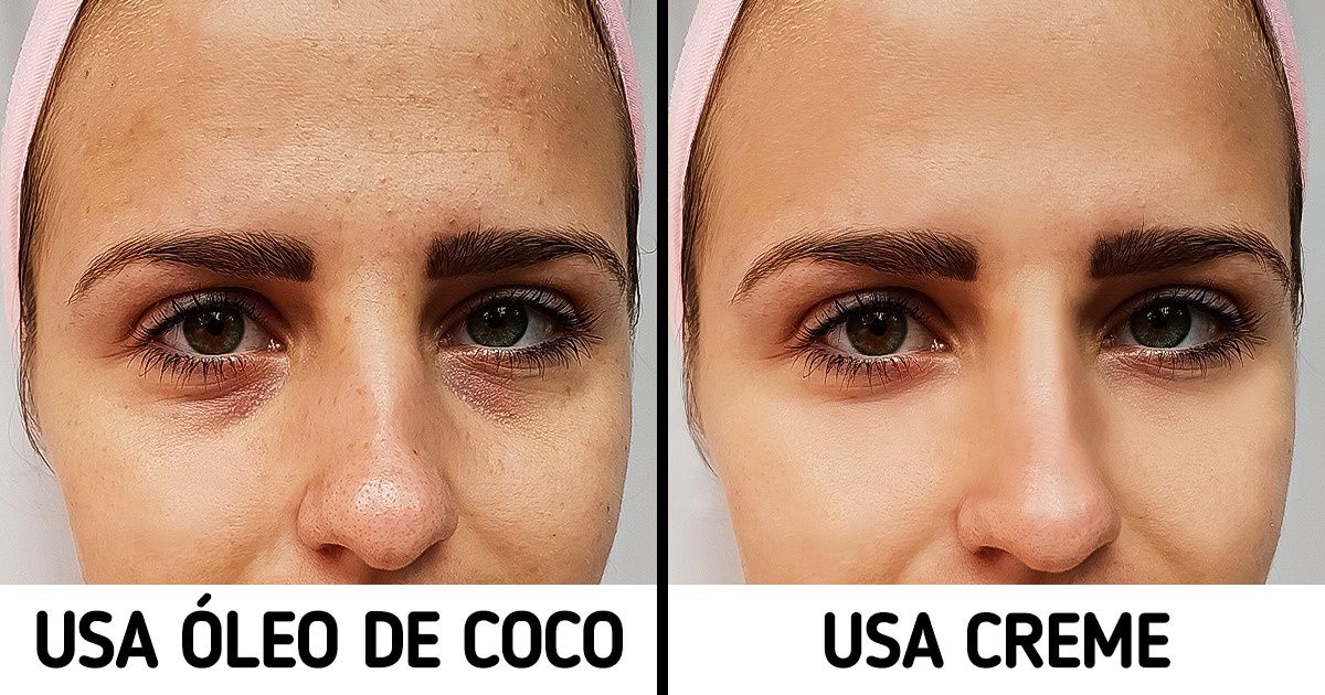 8 Procedimentos de beleza que, provavelmente, é melhor evitar
