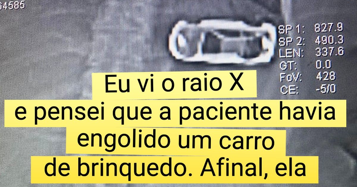 15+ Evidências de que radiografias podem guardar surpresas inesperadas 15+ Evidências de que radiografias podem guardar surpresas inesperadas
