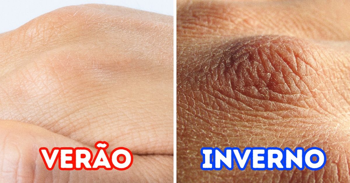 7 Coisas que podem acontecer com o seu corpo no inverno 7 Coisas que podem acontecer com o seu corpo no inverno