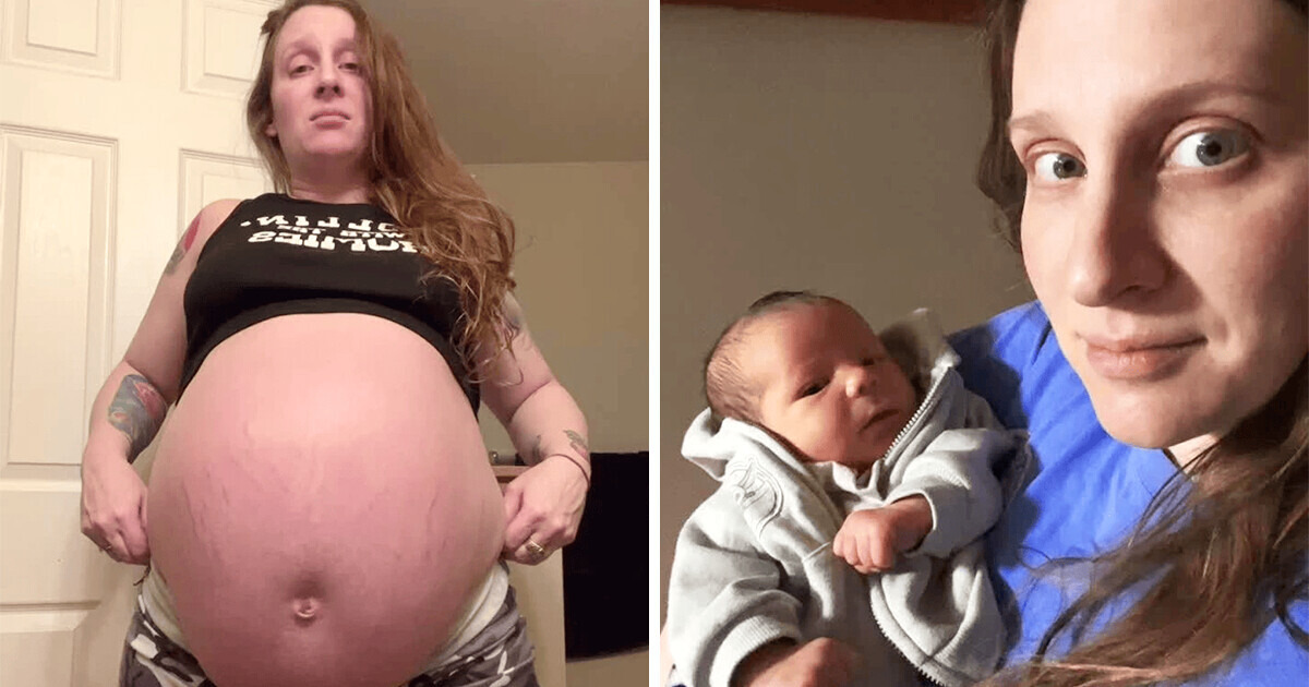Mulher choca os internautas com fotos da sua barriga durante a gestação e conta o motivo por trás disso