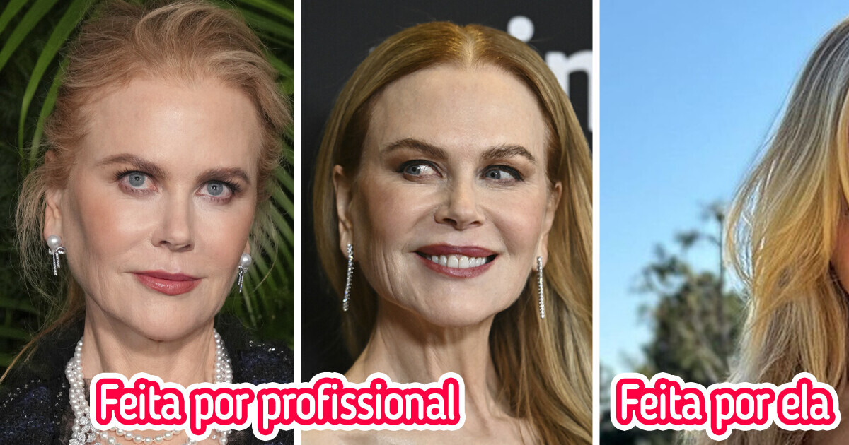 Nicole Kidman surge deslumbrante em evento, mas um detalhe de seu visual caiu na boca do povo Nicole Kidman surge deslumbrante em evento, mas um detalhe de seu visual caiu na boca do povo