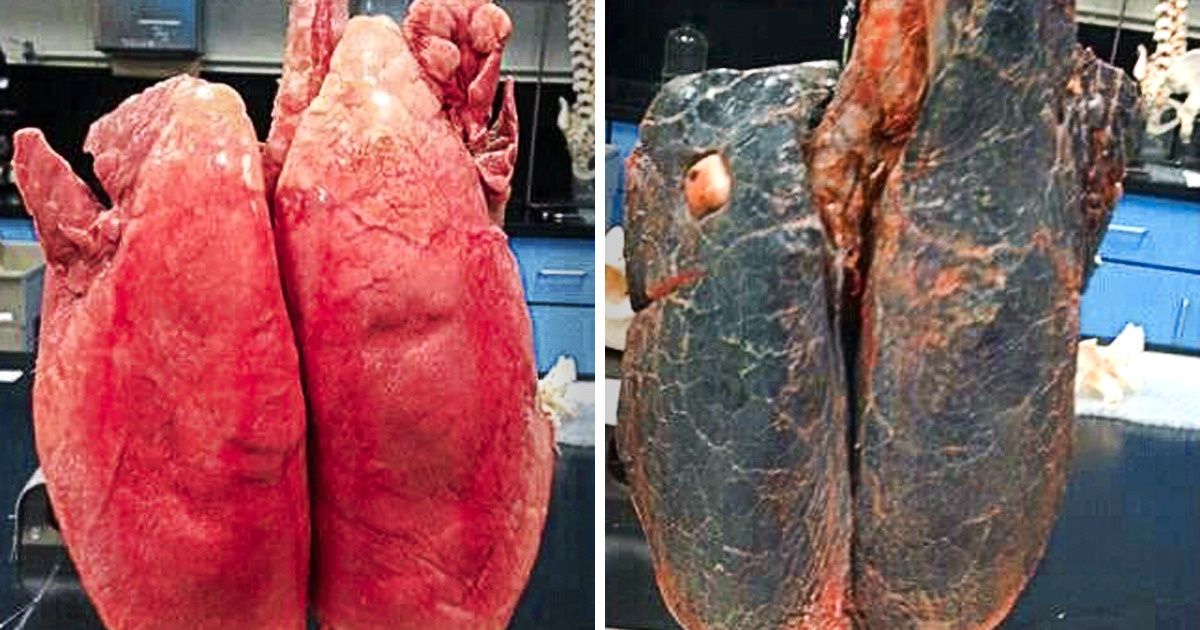 8 Formas efetivas de parar de fumar