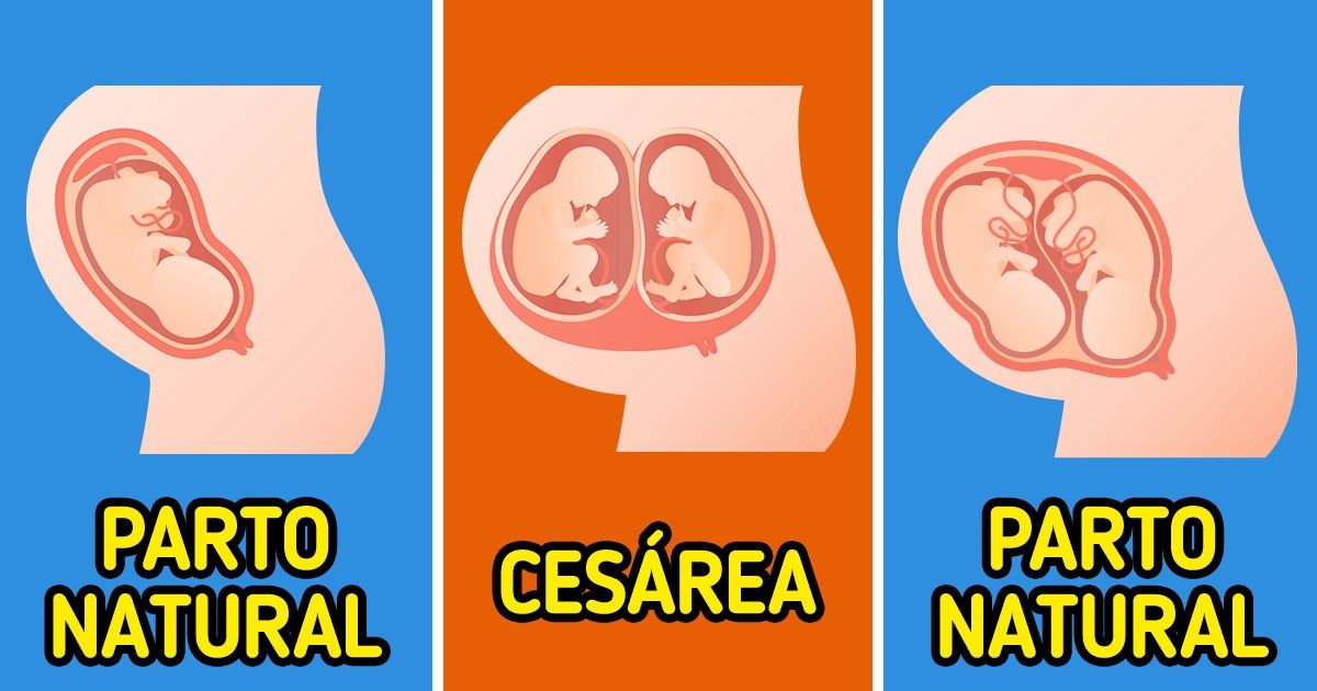10 Coisas diferentes que as mulheres experimentam quando estão grávidas de mais de um bebê 10 Coisas diferentes que as mulheres experimentam quando estão grávidas de mais de um bebê