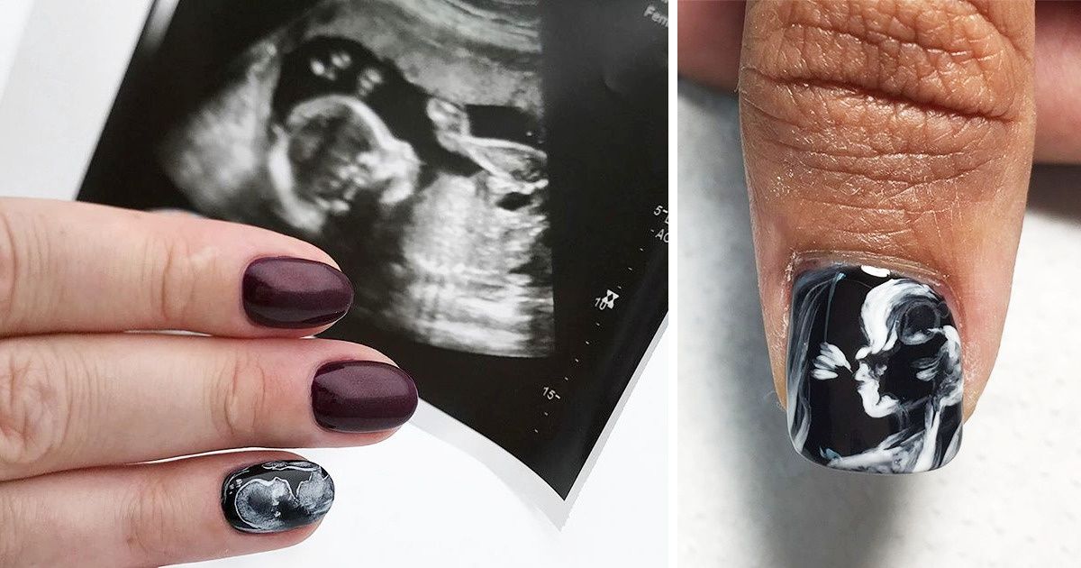 Mulheres grávidas estão usando a imagem do ultrassom como pintura de unhas Mulheres grávidas estão usando a imagem do ultrassom como pintura de unhas