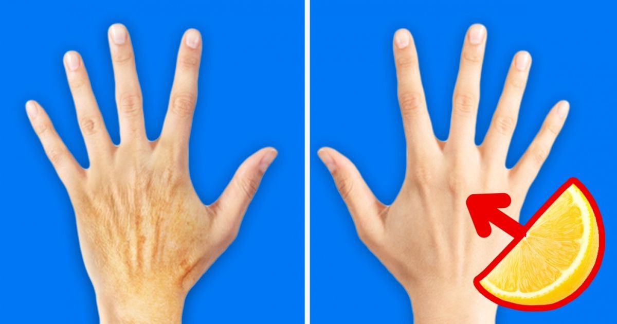 O que fazer para as mãos parecerem 10 anos mais jovens O que fazer para as mãos parecerem 10 anos mais jovens