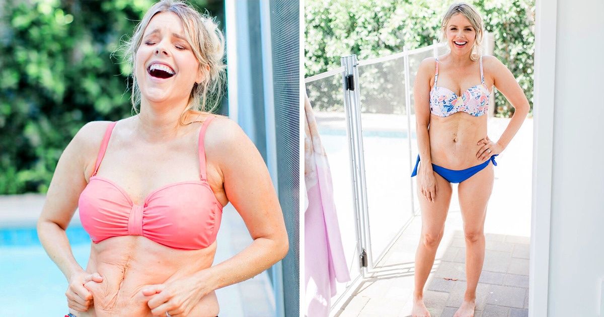 8 Famosas que mudaram depois de dar à luz e não se envergonham das imperfeições de seus corpos 8 Famosas que mudaram depois de dar à luz e não se envergonham das imperfeições de seus corpos