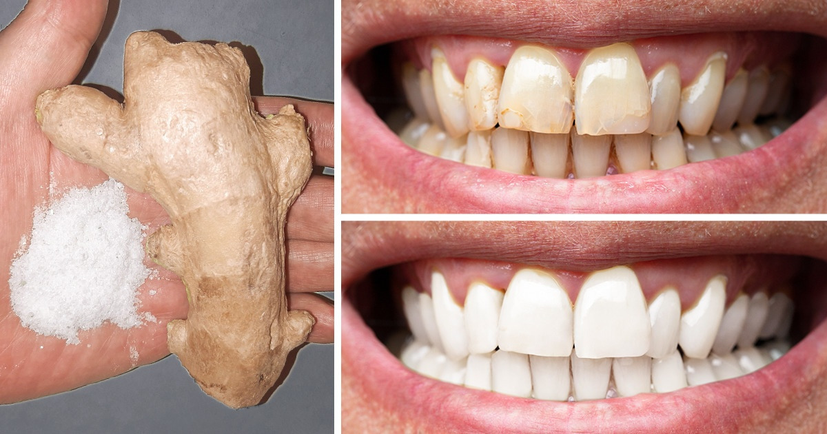 8 Maneiras naturais de deixar seus dentes mais brancos em casa 8 Maneiras naturais de deixar seus dentes mais brancos em casa