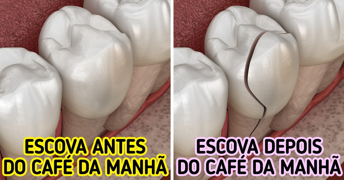 Por que é melhor não escovar os dentes logo após o café da manhã Por que é melhor não escovar os dentes logo após o café da manhã