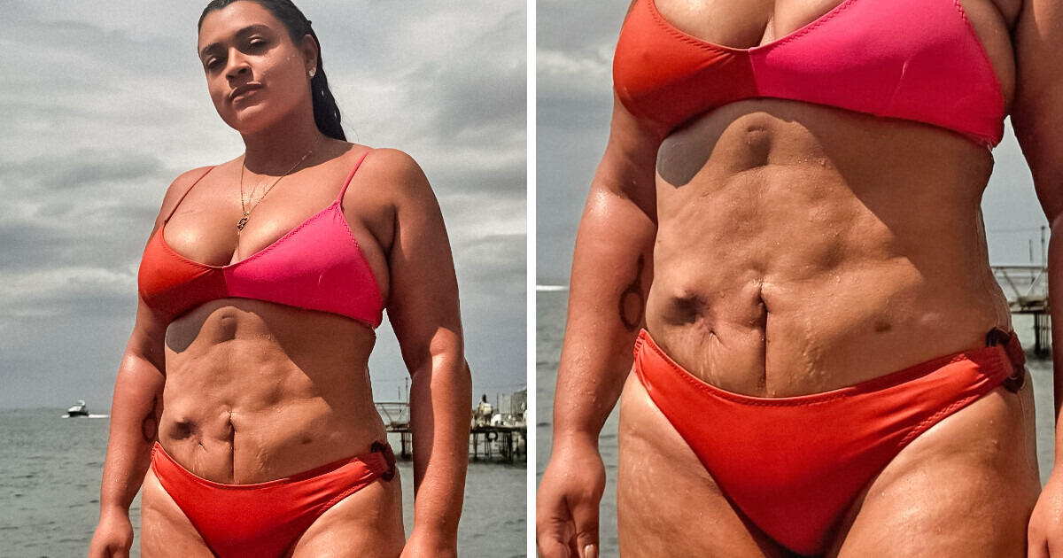 5 Famosas brasileiras que não têm receio de mostrar suas “imperfeições” 5 Famosas brasileiras que não têm receio de mostrar suas “imperfeições”