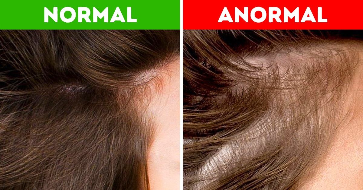 O que o estado dos seus cabelos diz sobre a sua saúde