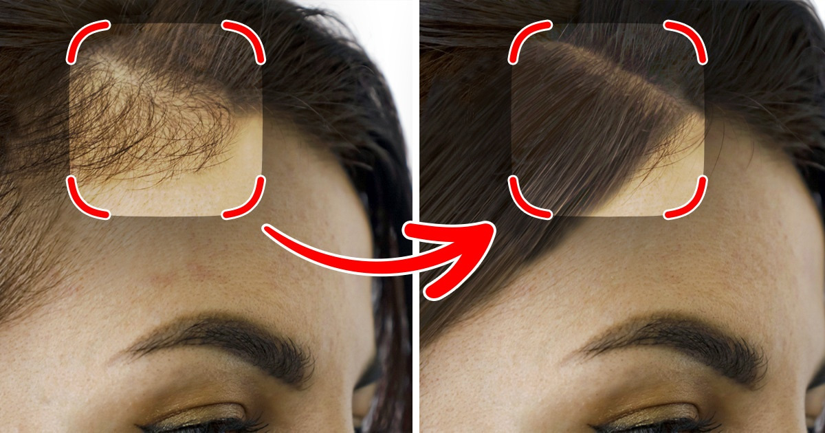 7 Dicas que podem ajudar o cabelo a crescer mais forte
