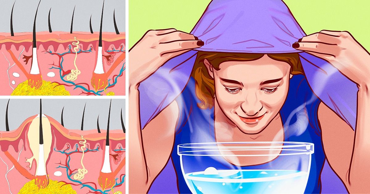 5 Possíveis benefícios da vaporização na face, se feita uma vez por semana 5 Possíveis benefícios da vaporização na face, se feita uma vez por semana