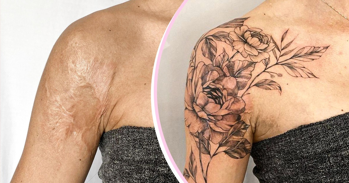 15 Pessoas que recuperaram a confiança após converter suas cicatrizes em obras de arte