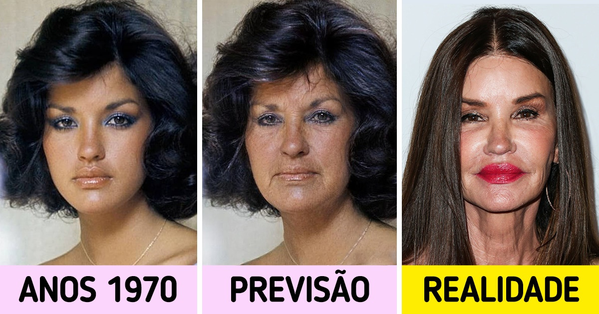 Como 10 celebridades seriam se nunca tivessem feito procedimentos estéticos