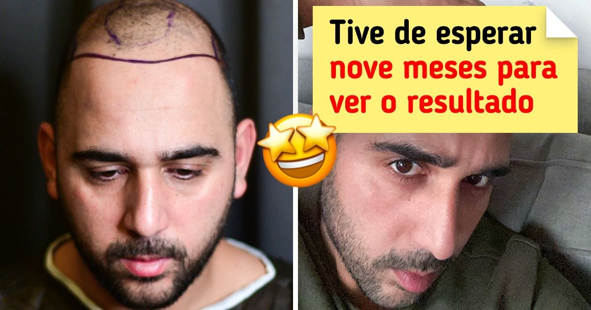 20 Pessoas que decidiram fazer grandes mudanças em suas vidas, começando pela aparência