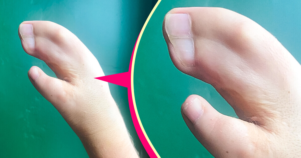 13 Pessoas cujos traços singulares elevam o corpo a uma forma de arte