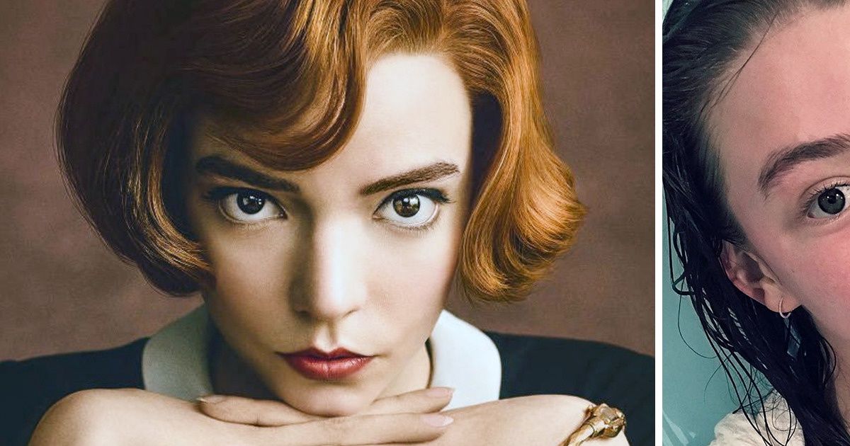 Celebridades compartilham fotos ao natural e surpreendem pela beleza e honestidade